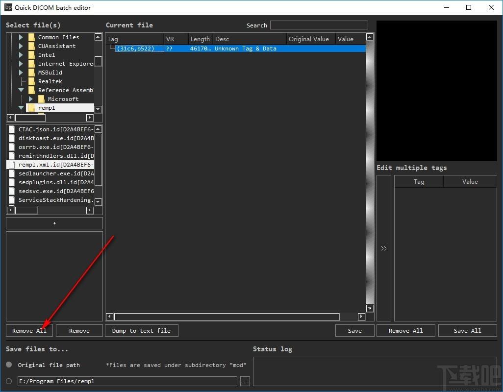 Quick Dicom batch editor下载,DICOM标签浏览编辑器